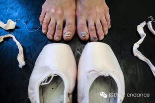芭蕾舞演员谭元元的脚